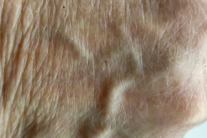 varttuneen ihmisen kämmenselkämys, jossa näkyvat juonteet, ihopoimut ja suonet